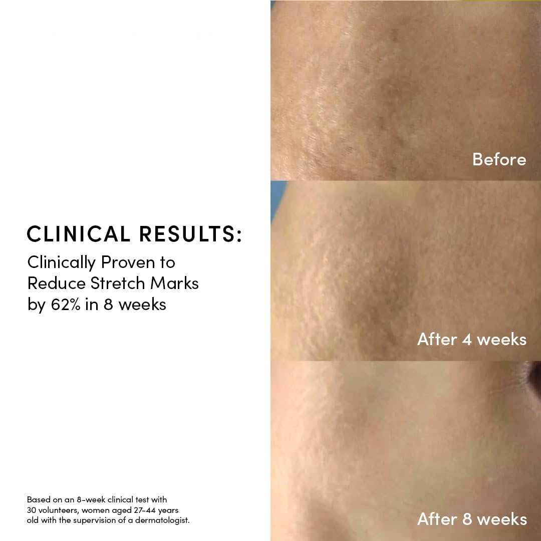 Evereden Golden Belly Serum, 1.7 fl oz. | Clean & Vegan Women's Belly Oil for Pregnancy and Postpartum | Clean Maternity Skincare | Non-Toxic Stretch Mark Oil