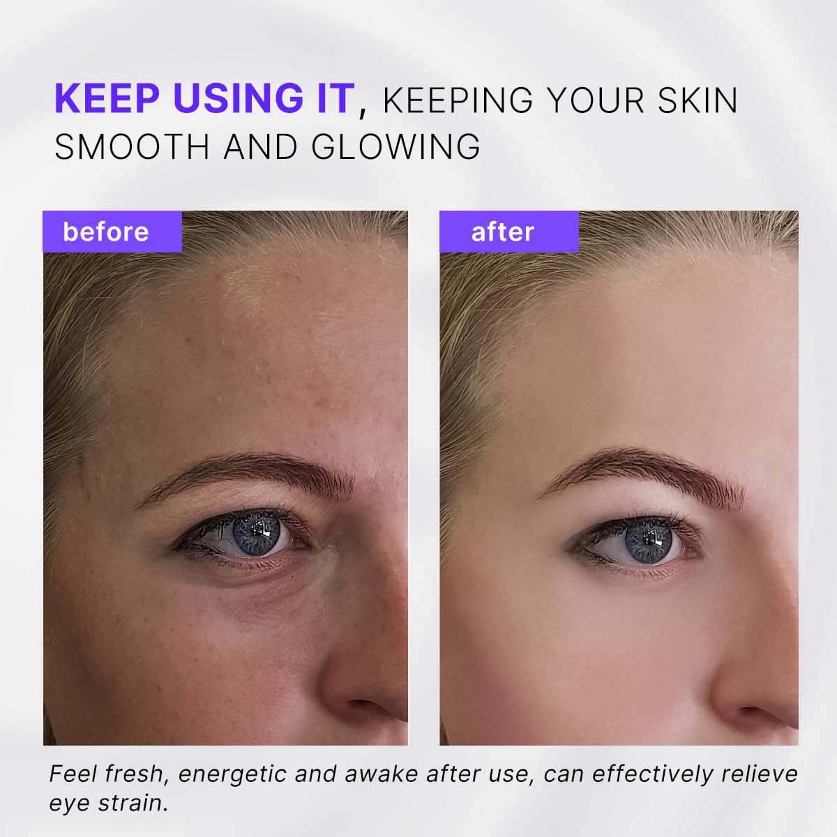 Eye Roller, Facial Ice Roller Massager - Reduces Puffiness, Dark Circles, Cooling Therapy for Tired Eyes (With Applicator)