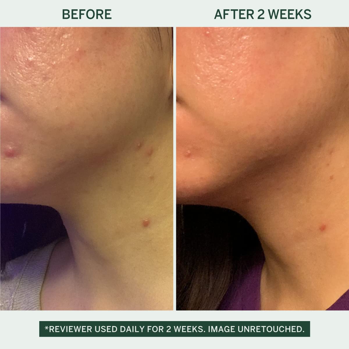 Urban Calm Collection Gift Set - Hydrating, Smoothing, Exfoliating, and Soothing Skincare Set for All Skin Types - Includes Fermented Skincare Products: Cleanser, Essence, Serum, and Cream