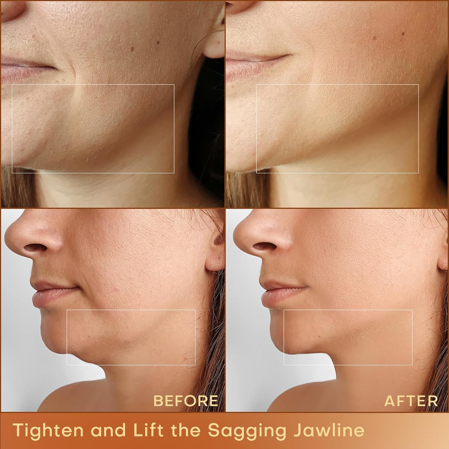 MLAY Professional RF Beauty Machine, Radio Frequency Face Machine with 2 Probes, at Home Radio Frequency Skin Tightening for Lifting, Wrinkle Reducing, Anti Aging - Salon Effects（Gel Included）