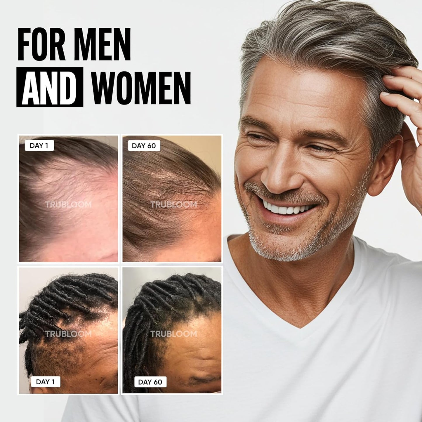 St. Tropica Tru Bloom Hair Growth Vitamins - 2 Month Supply. Clinically Proven to Grow Fuller, Thicker Hair. Natural & Drug-Free with Biotin, MSM, Zinc, D3 + Hair Superfoods. Non GMO