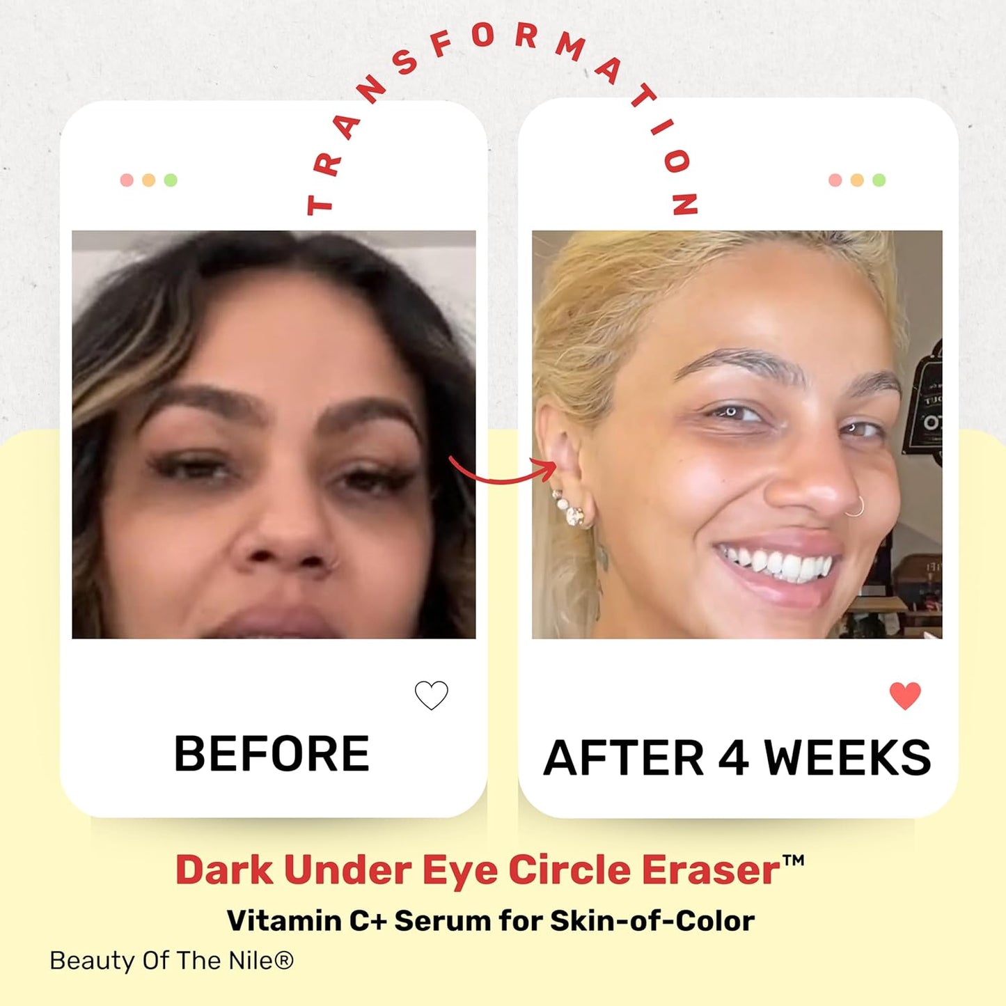 Dark Under Eye Circle Eraser™ Vitamin C+ Serum for Skin-of-Color, Dark Circle Puffiness Wrinkle Hyaluronic Acid Superoxide D, Beauty of the Nile® 1 Oz